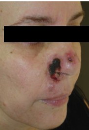 Necrose.jpg Necrose.jpg